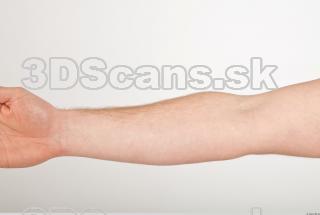 Photo reference of forearm 0001